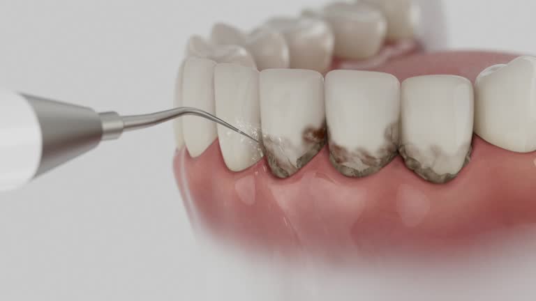 Reliable Dental Implants contractor in Lemay, MO by Smile Center Dentistry